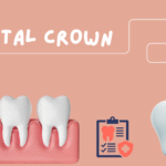 Dental Crown