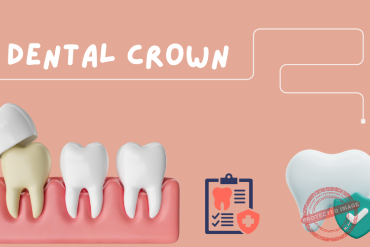 Dental Crown