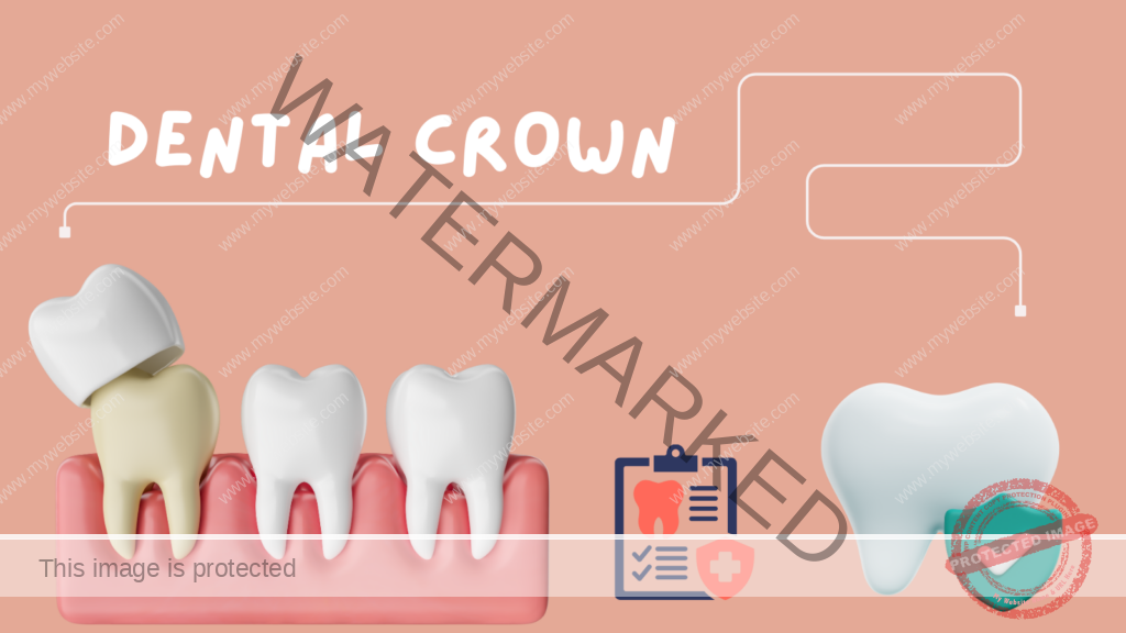 Dental Crown
